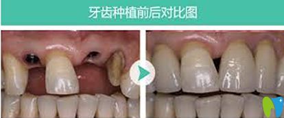 廈門瑞爾口腔門診部怎么樣 地址 電話 醫生團隊 案例 口碑評價 開立特口腔