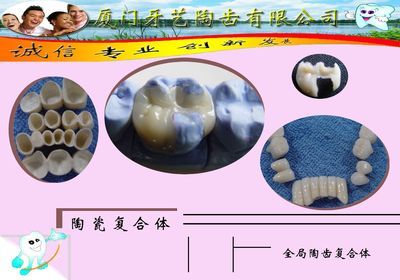 廈門(mén)牙藝陶齒-原永達(dá)